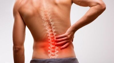 Semne și simptome ale unei osteocondroze a coloanei vertebrale lombare
