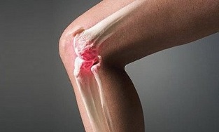 cum diferă artrita de osteoartrita