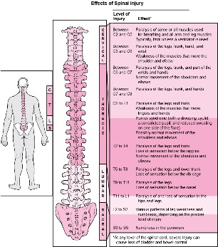 Boli în organism asociate cu deteriorarea diferitelor părți ale coloanei vertebrale