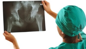diagnostic instrumental al osteoartritei articulației șoldului