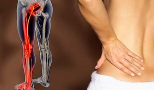 Caracteristicile durerilor de spate